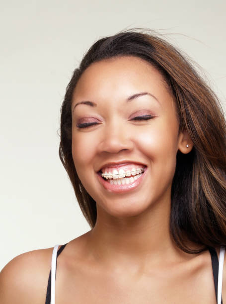 Teeth Braces Types: A Complete Guide