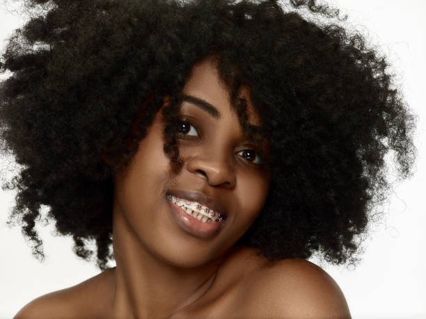 Dental Braces: What Are Dental Braces?
