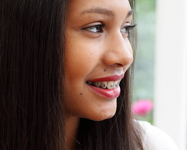 Dental Braces: What Are Dental Braces?