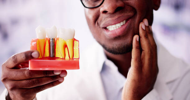 Dental Implants vs Bridges: Which Is the Better Option for Replacing Missing Teeth?