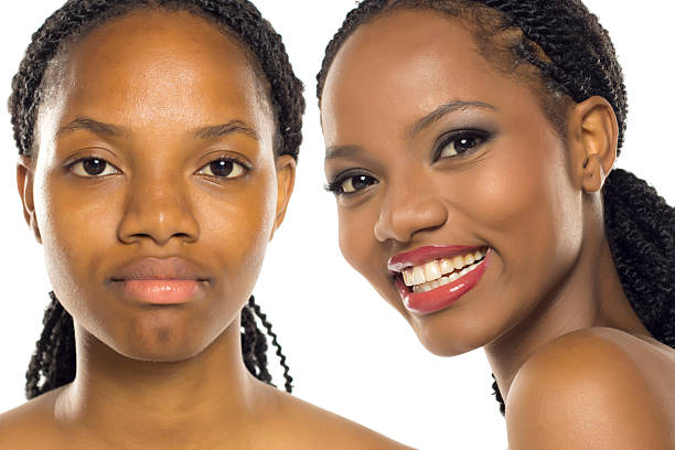 Before and After Dental Braces: What Results Can You Expect?